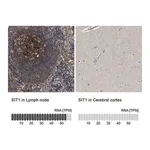 Merck Anti-SIT1 antibody produced in rabbit