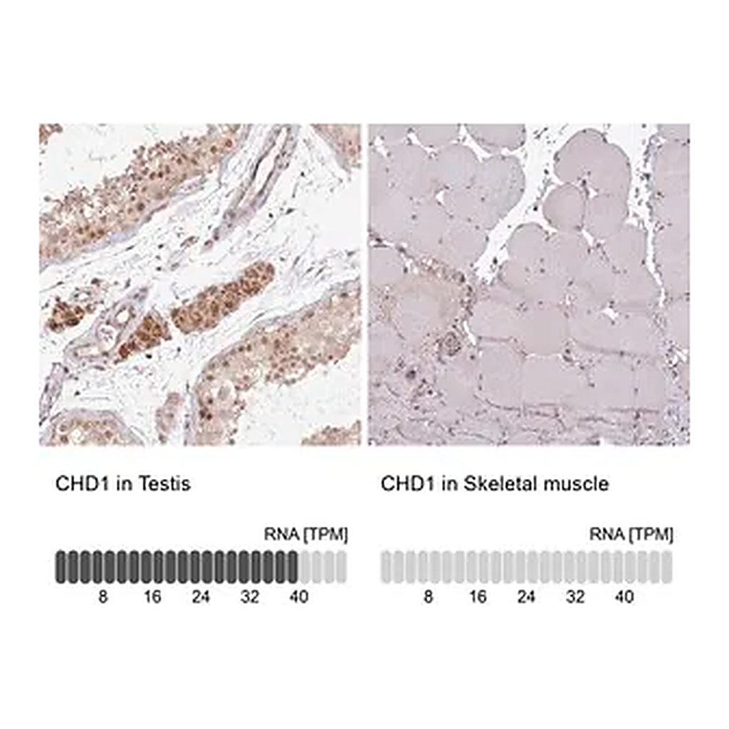 Merck Anti-CHD1 antibody produced in rabbit
