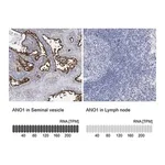 Merck Anti-ANO1 antibody produced in rabbit