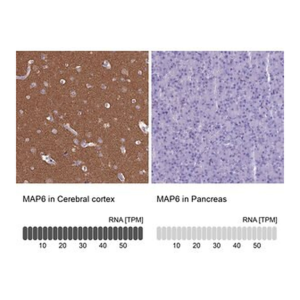 Merck Anti-MAP6 antibody produced in rabbit