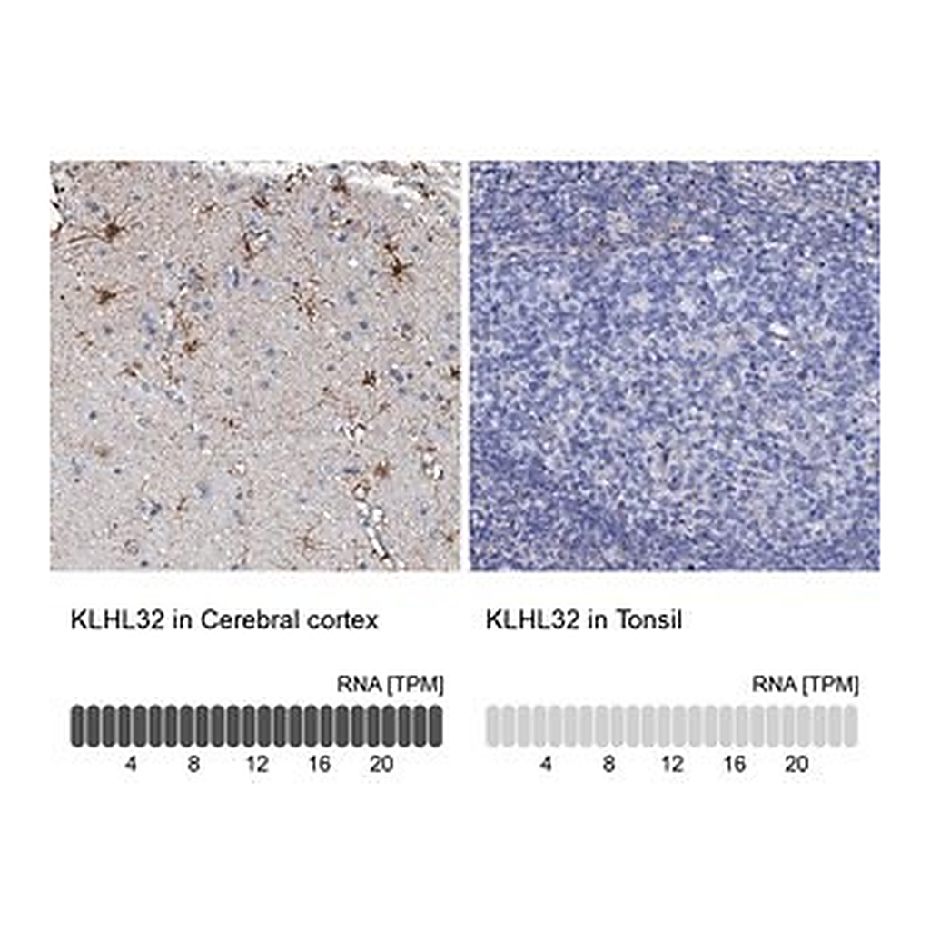 Merck Anti-KLHL32 antibody produced in rabbit