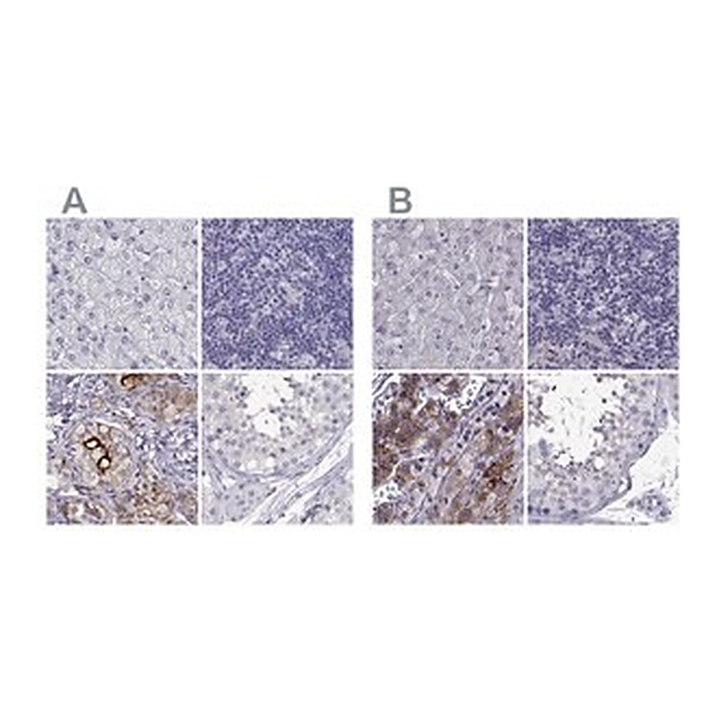 Merck Anti-IGSF1 antibody produced in rabbit