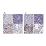 Merck Anti-IGSF1 antibody produced in rabbit