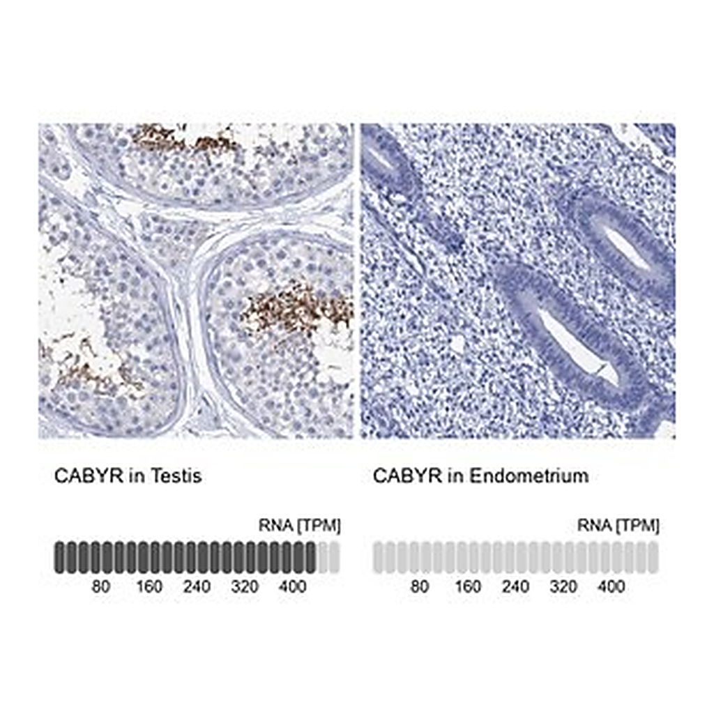 Merck Anti-CABYR antibody produced in rabbit