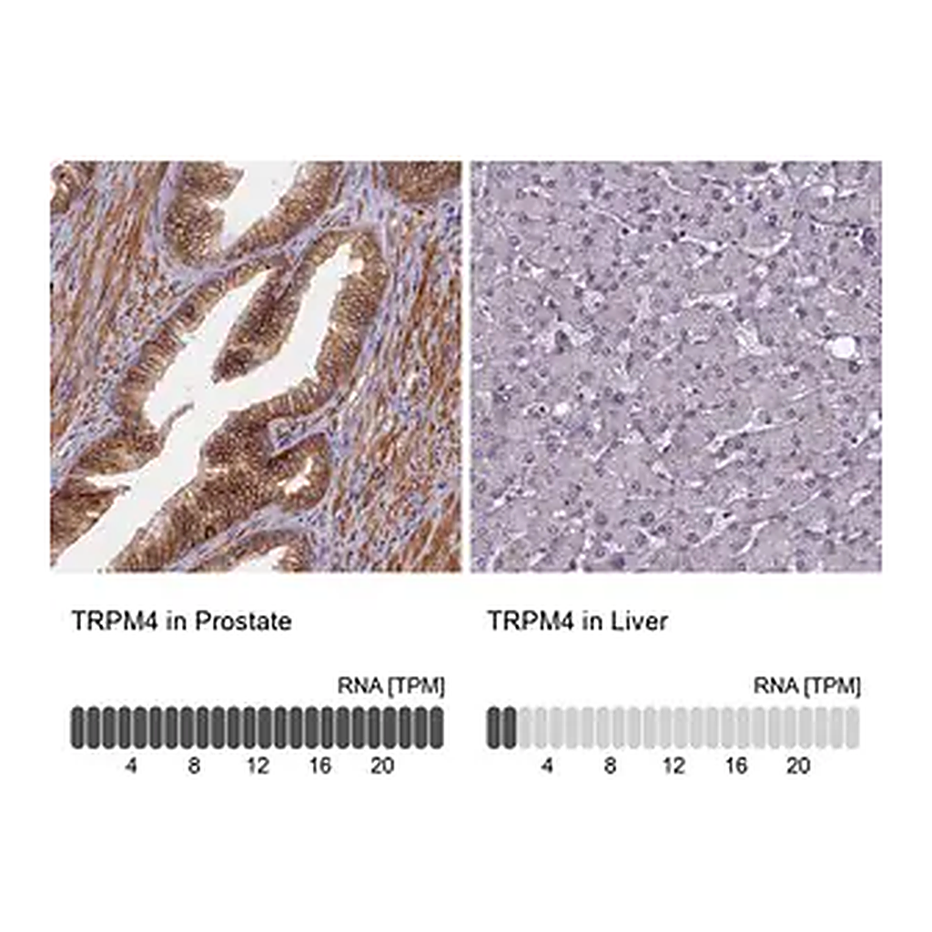 Merck Anti-TRPM4 antibody produced in rabbit