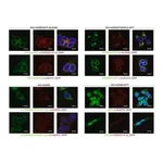 Merck Anti-PGRMC2 antibody produced in rabbit