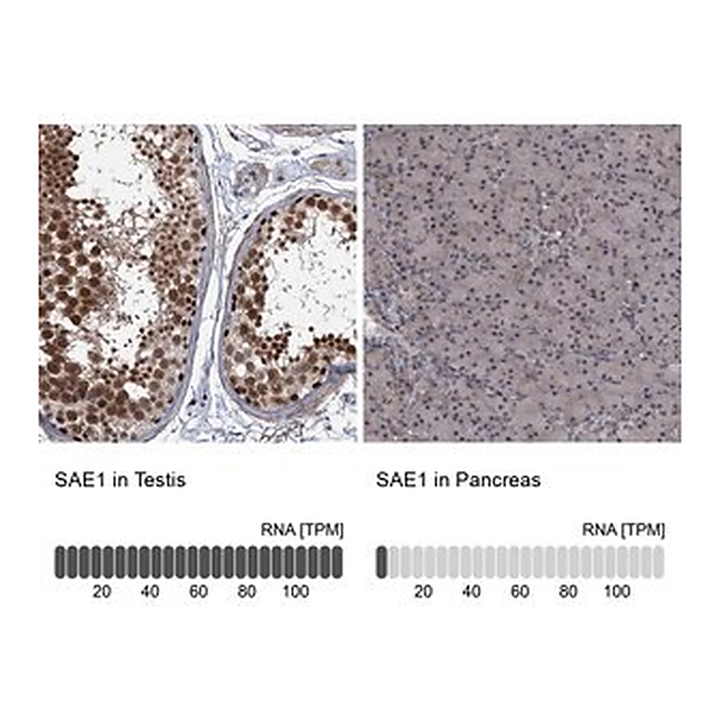 Merck Anti-SAE1 antibody produced in rabbit