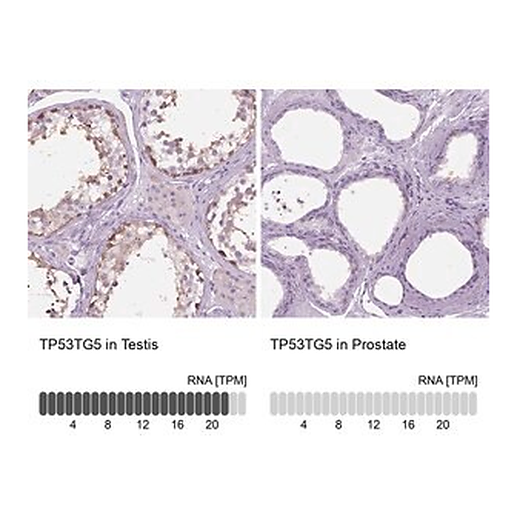 Merck Anti-TP53TG5 antibody produced in rabbit