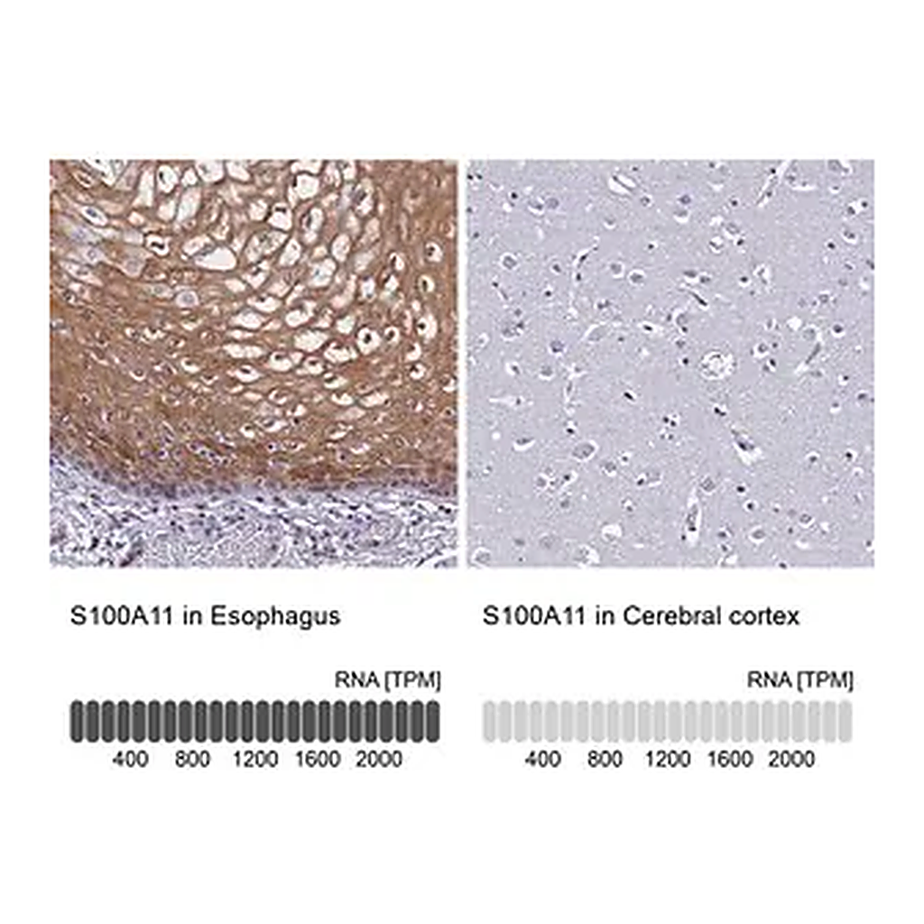 Merck Anti-S100A11 antibody produced in rabbit