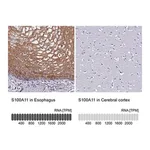 Merck Anti-S100A11 antibody produced in rabbit