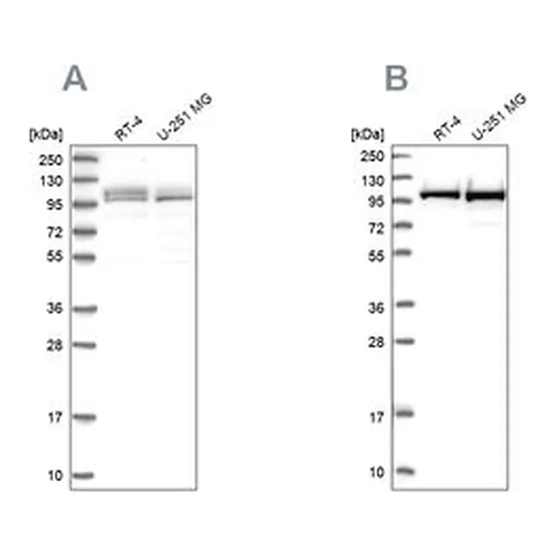 Merck Anti-RBM12 antibody produced in rabbit