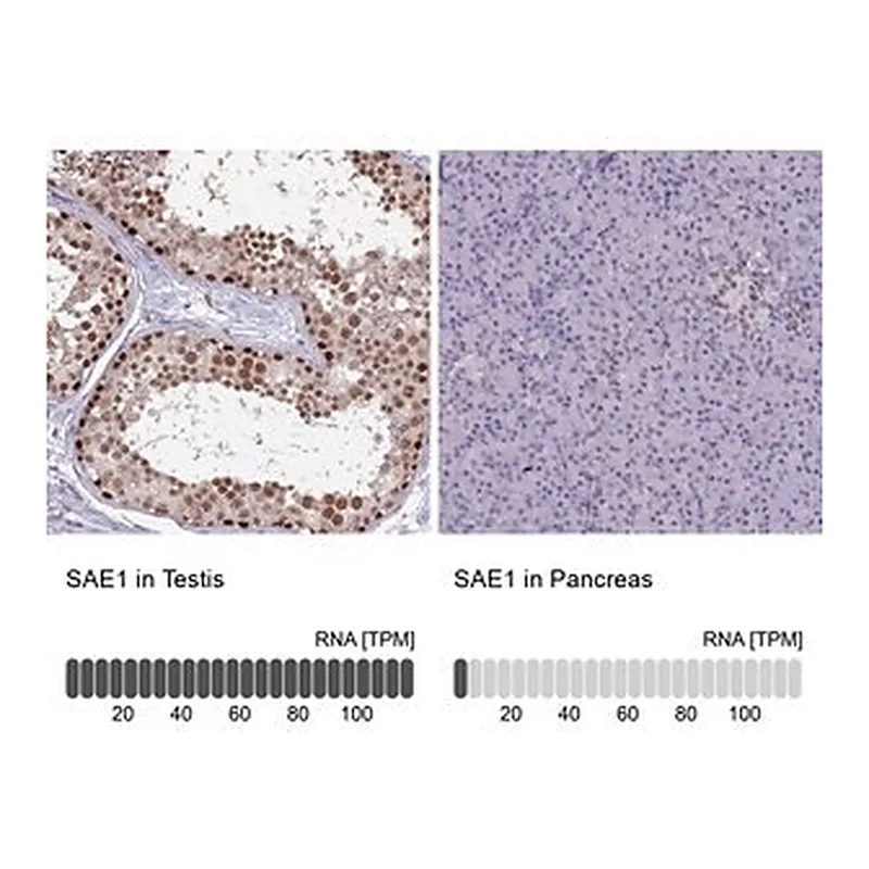 Merck Anti-SAE1 antibody produced in rabbit