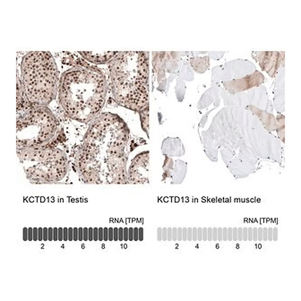 Merck Anti-KCTD13 antibody produced in rabbit