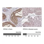 Merck Anti-PPP4C antibody produced in rabbit