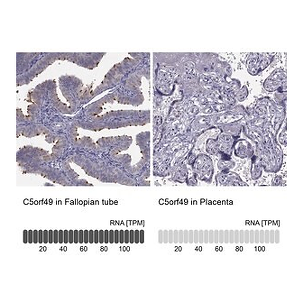 Merck Anti-C5ORF49 antibody produced in rabbit