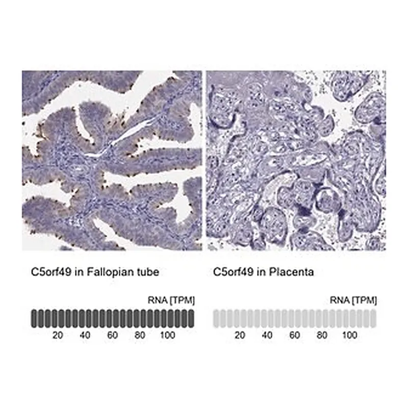 Merck Anti-C5ORF49 antibody produced in rabbit