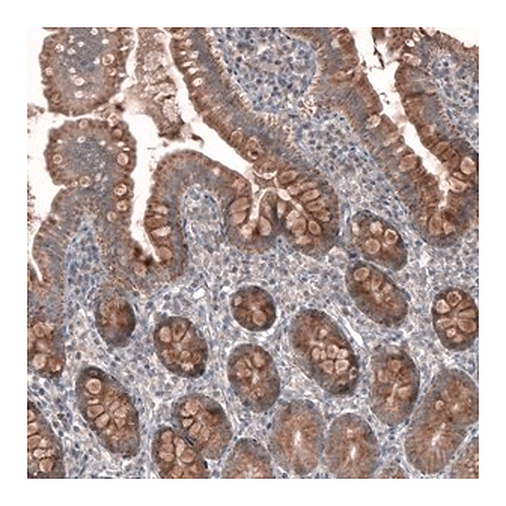 Merck Anti-FASTKD1 antibody produced in rabbit