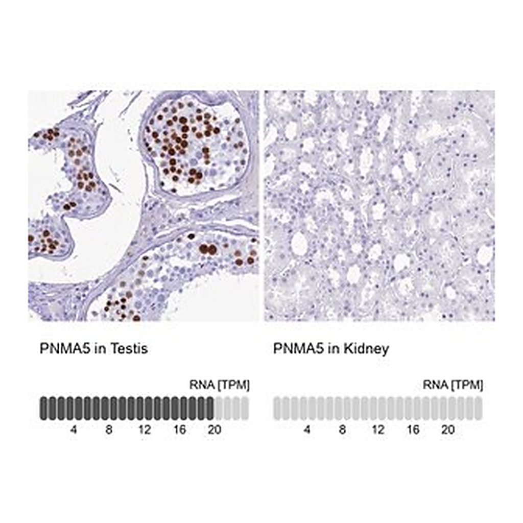 Merck Anti-PNMA5 antibody produced in rabbit