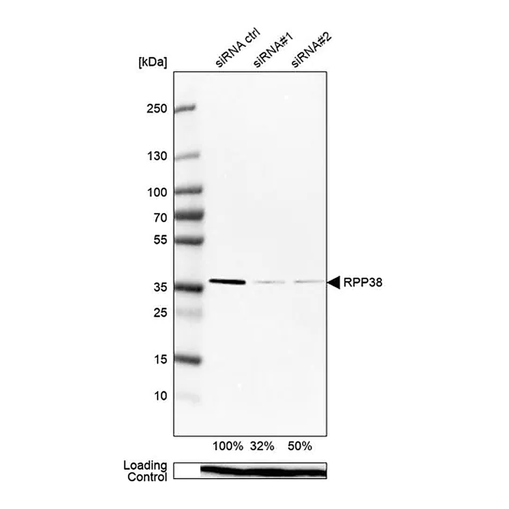 Merck Anti-RPP38 antibody produced in rabbit