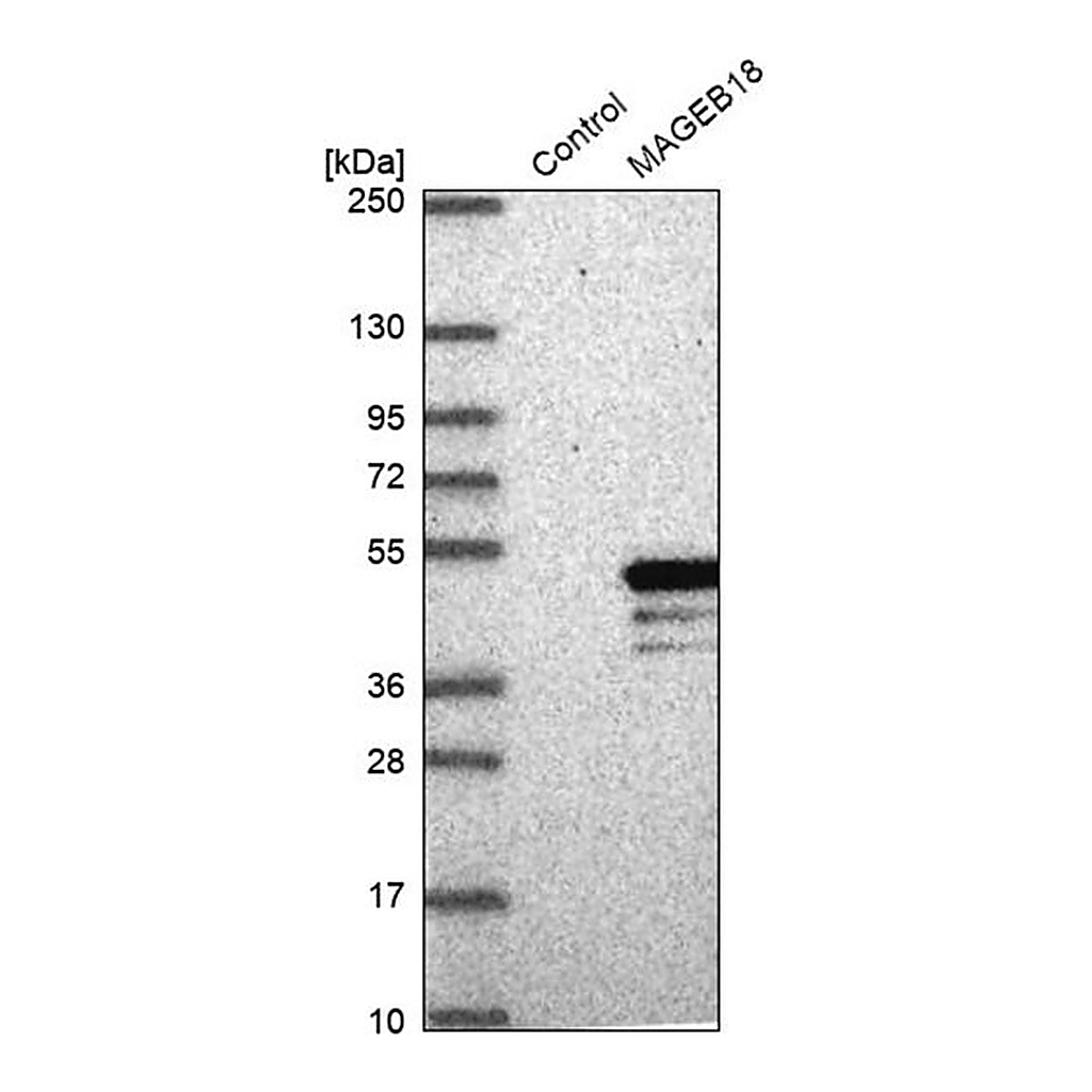 Merck Anti-MAGEB18 antibody produced in rabbit