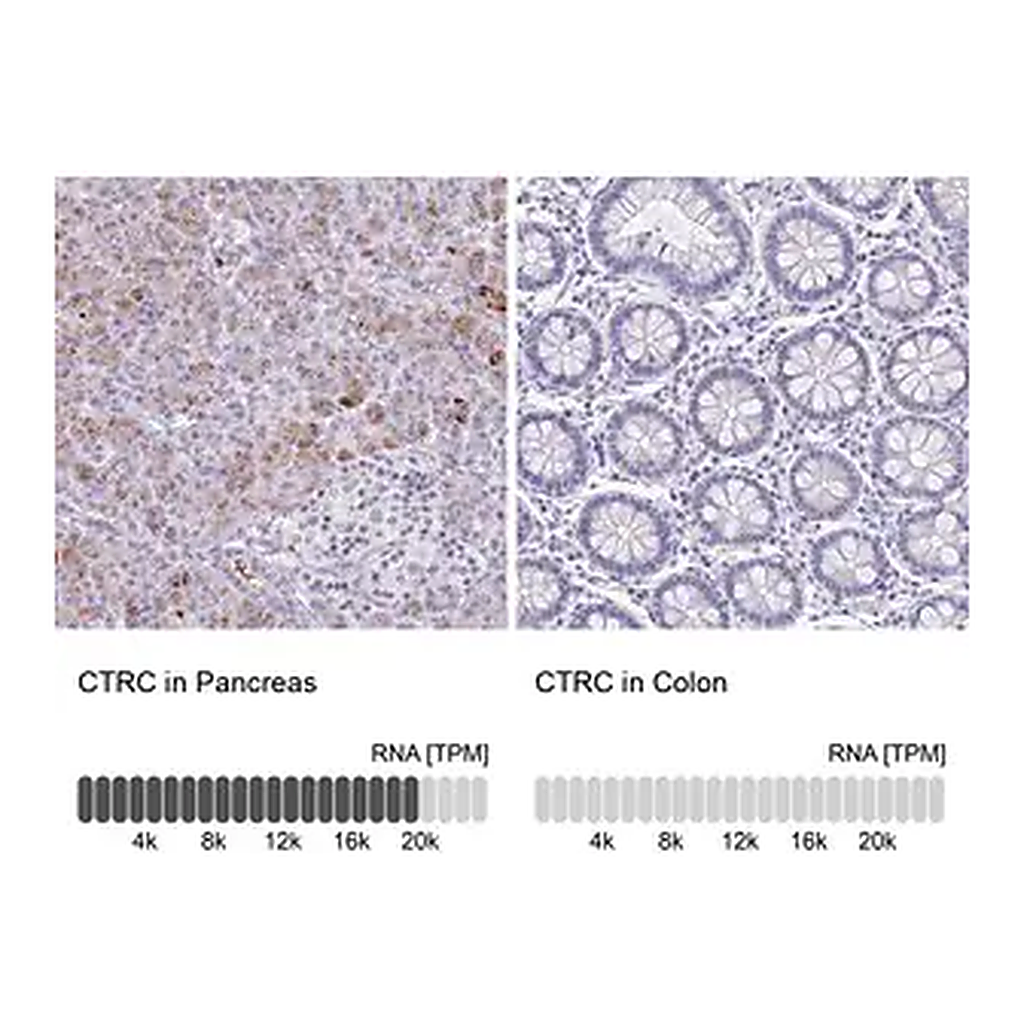 Merck Anti-CTRC antibody produced in rabbit