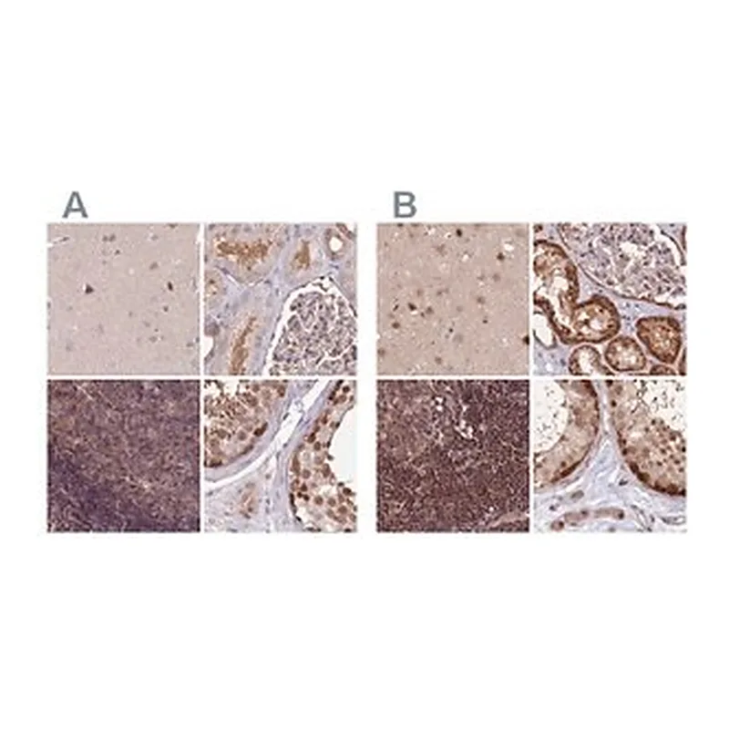 Merck Anti-NSFL1C antibody produced in rabbit
