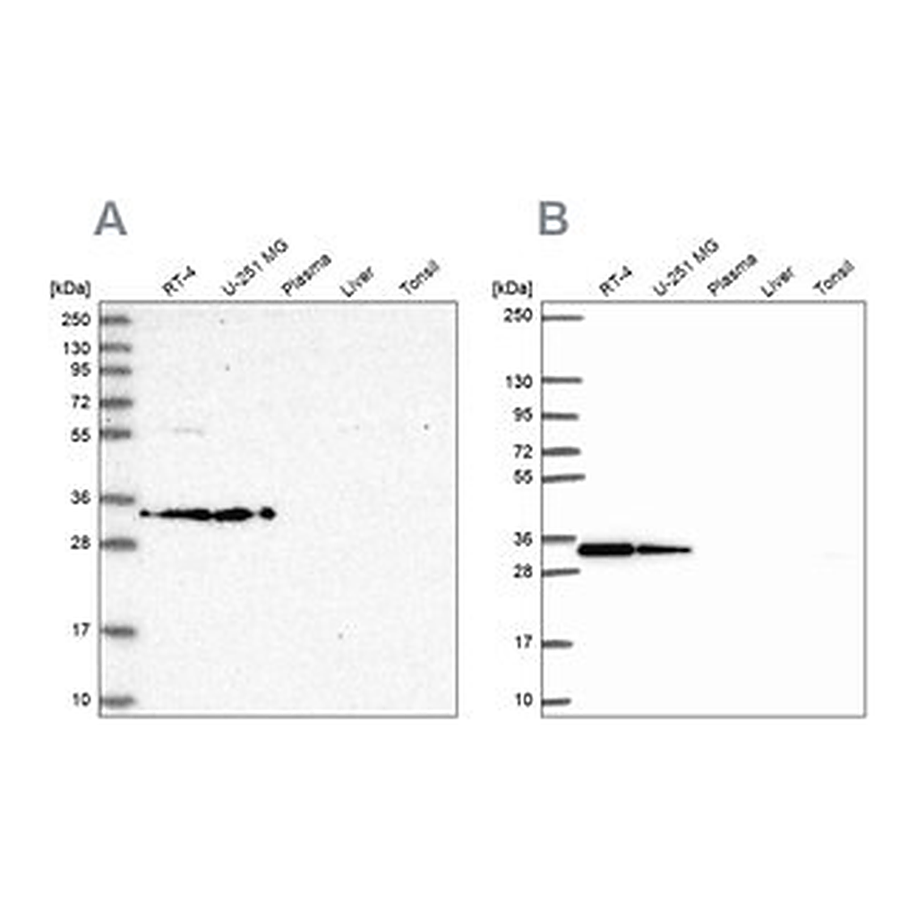 Merck Anti-RPS3A antibody produced in rabbit