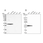 Merck Anti-RPS3A antibody produced in rabbit