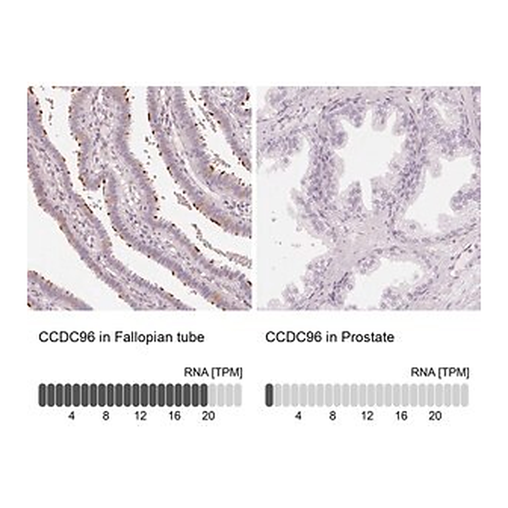 Merck Anti-CCDC96 antibody produced in rabbit