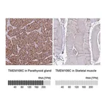 Merck Anti-TMEM106C antibody produced in rabbit