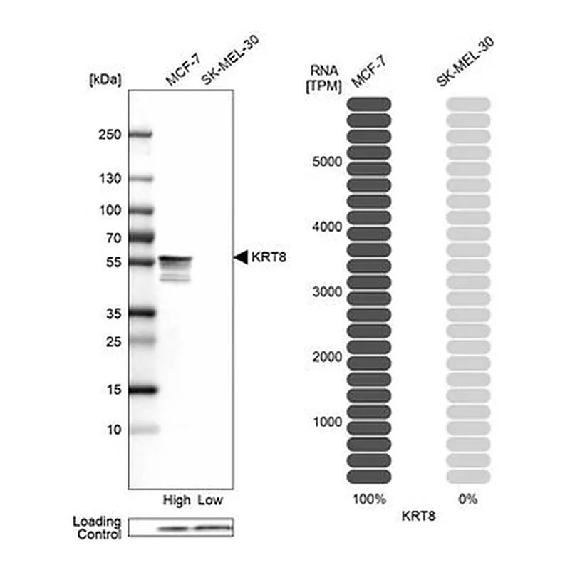 Merck Anti-KRT8 antibody produced in rabbit