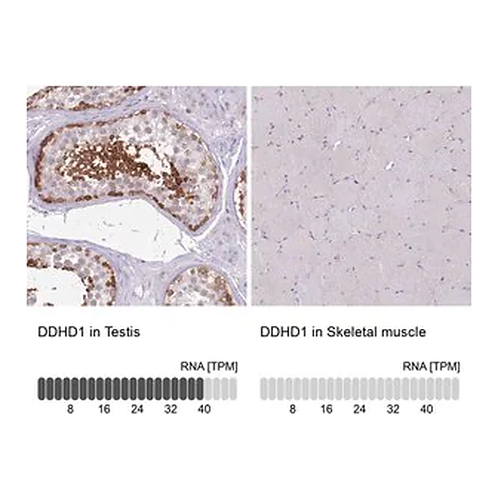 Merck Anti-DDHD1 antibody produced in rabbit
