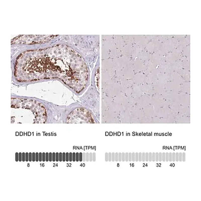 Merck Anti-DDHD1 antibody produced in rabbit