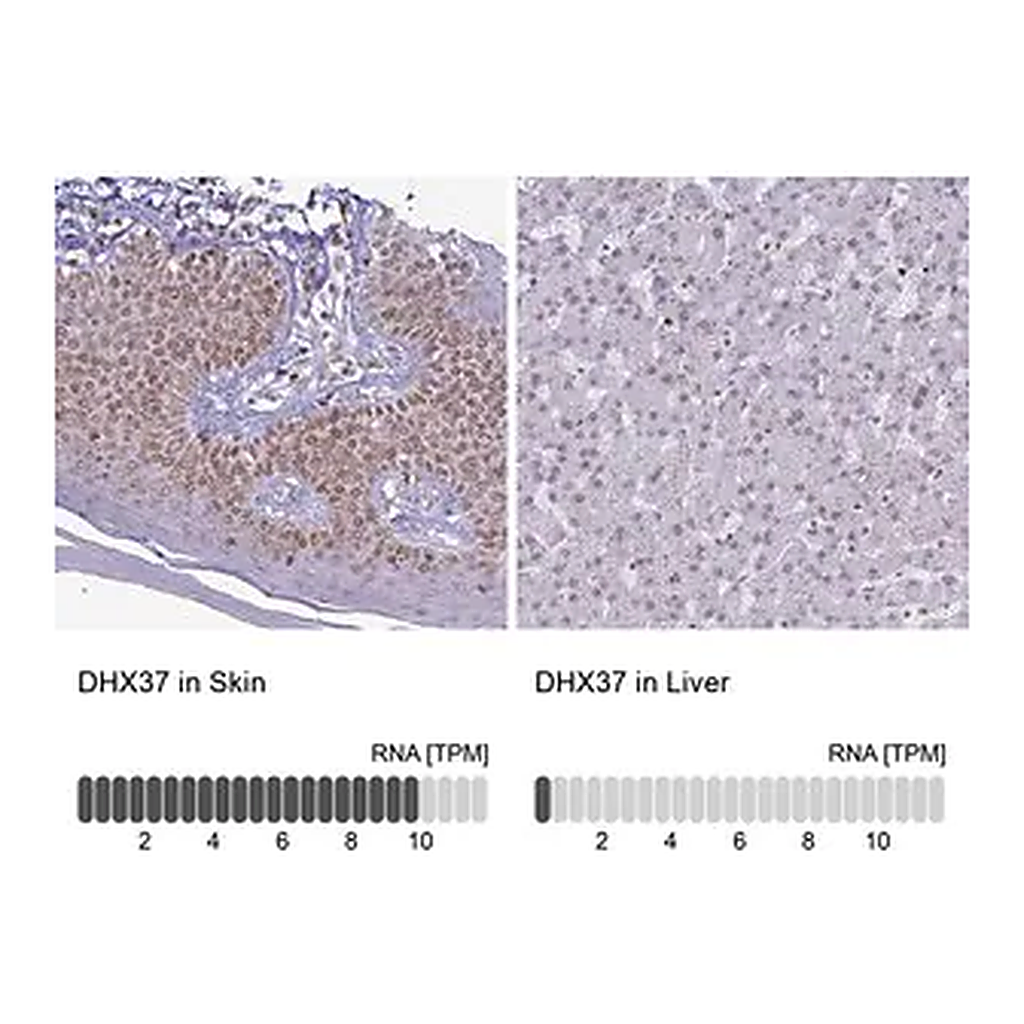Merck Anti-DHX37 antibody produced in rabbit