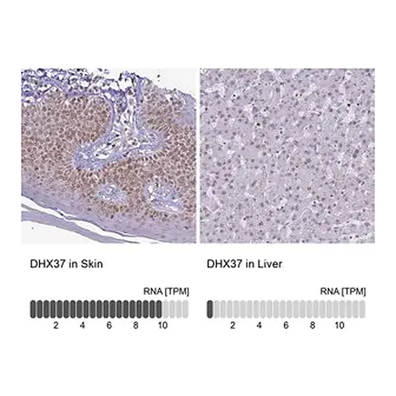 Merck Anti-DHX37 antibody produced in rabbit