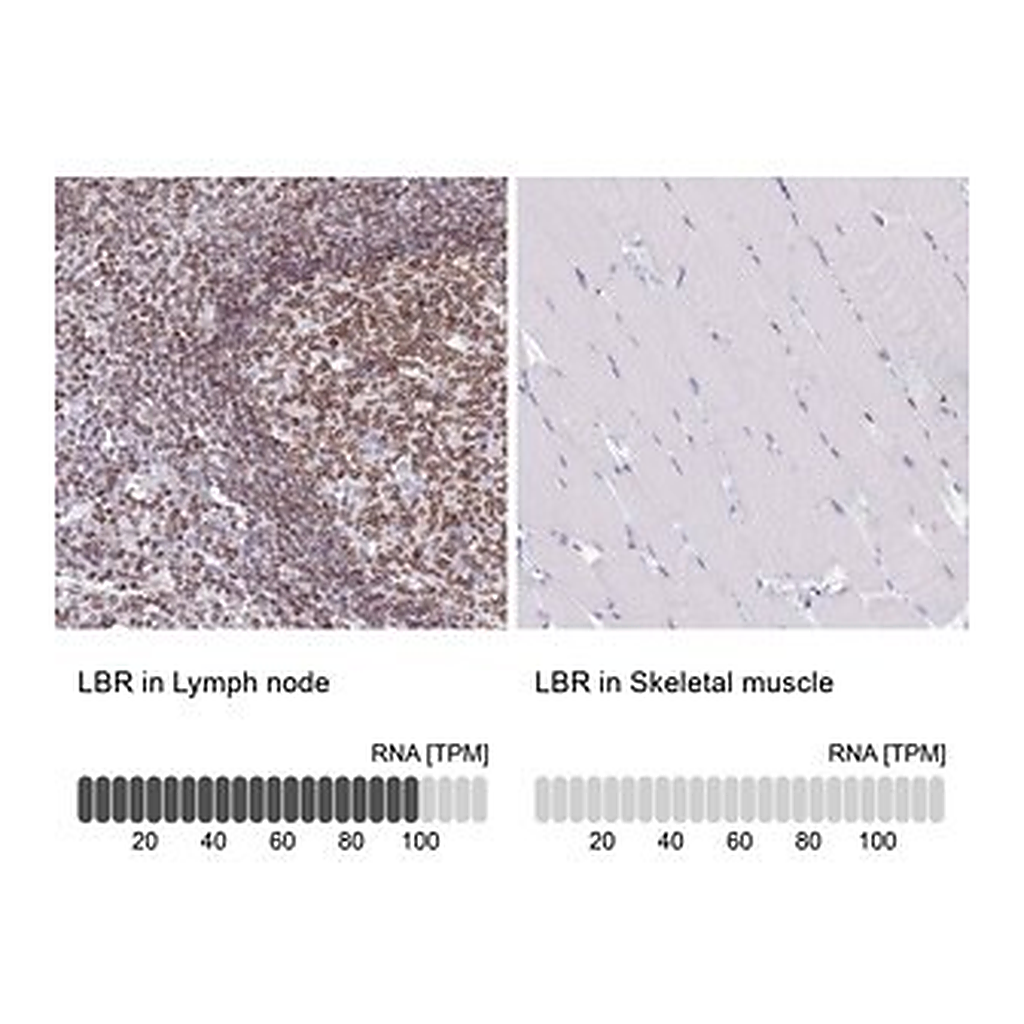 Merck Anti-LBR antibody produced in rabbit