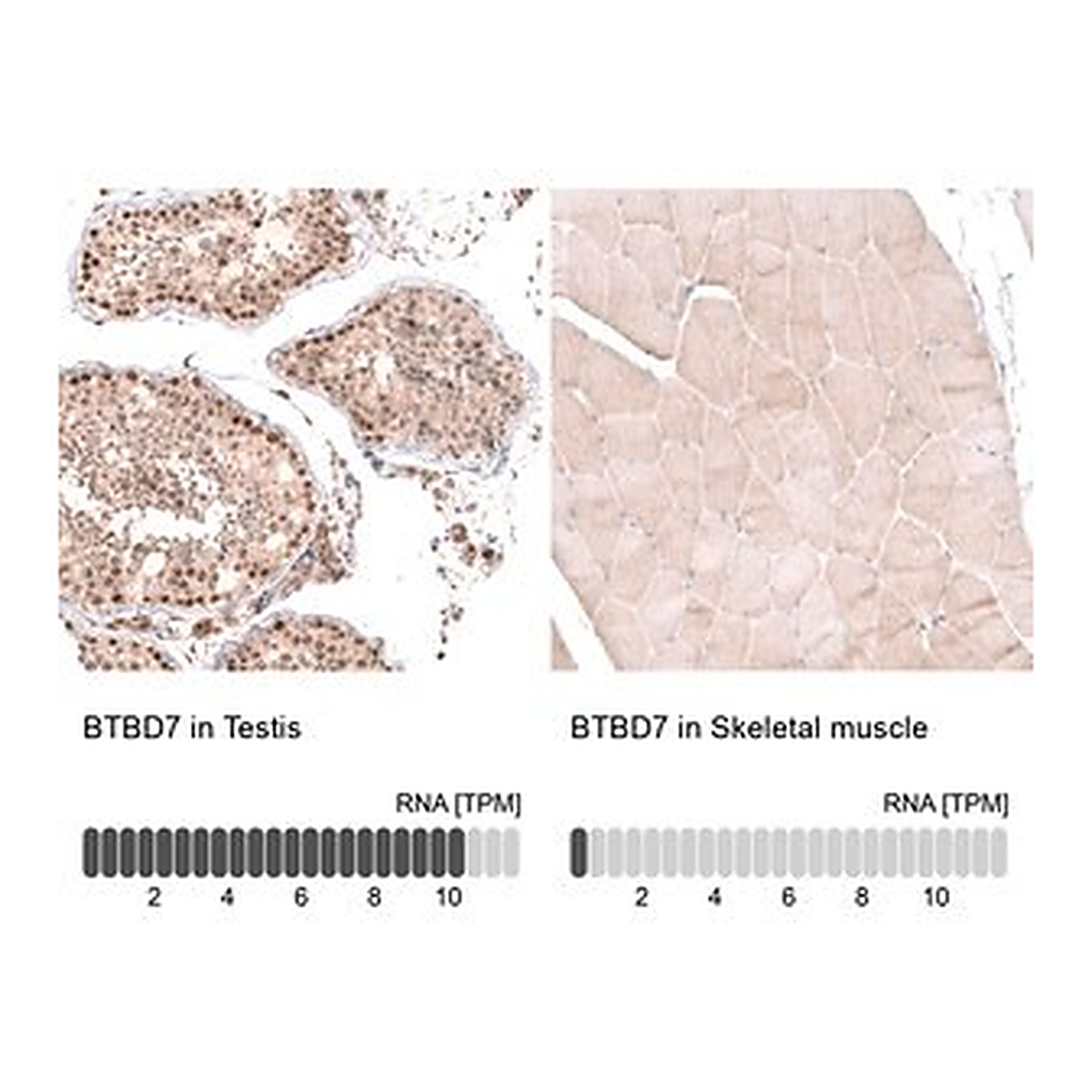 Merck Anti-BTBD7 antibody produced in rabbit