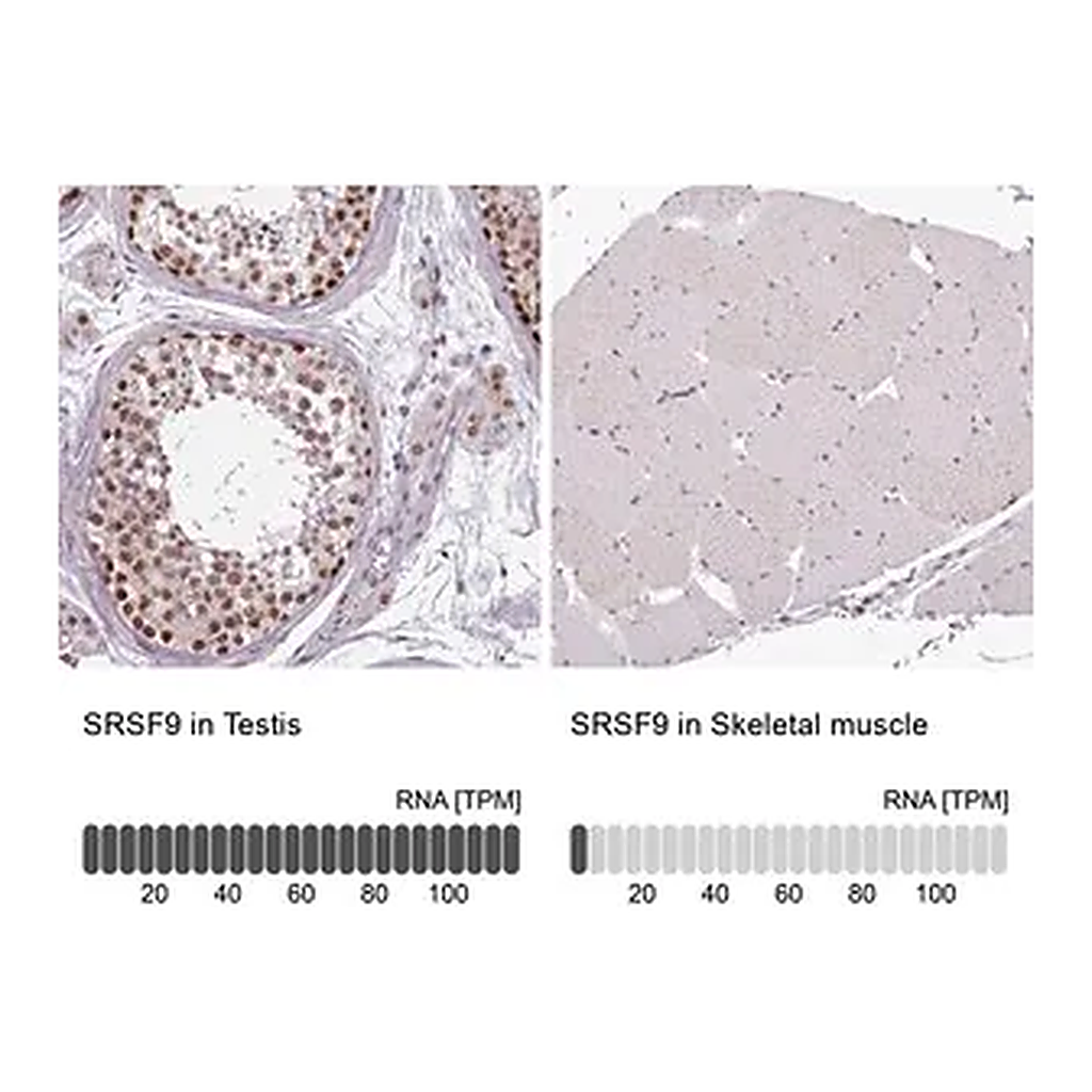 Merck Anti-SRSF9 antibody produced in rabbit