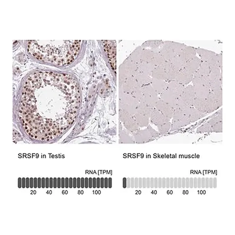 Merck Anti-SRSF9 antibody produced in rabbit