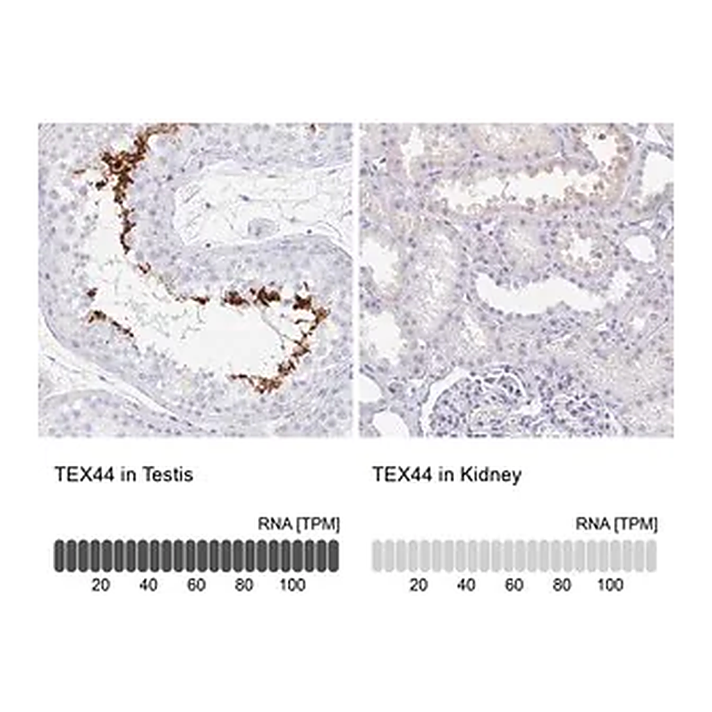 Merck Anti-TEX44 antibody produced in rabbit