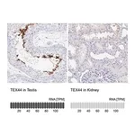 Merck Anti-TEX44 antibody produced in rabbit