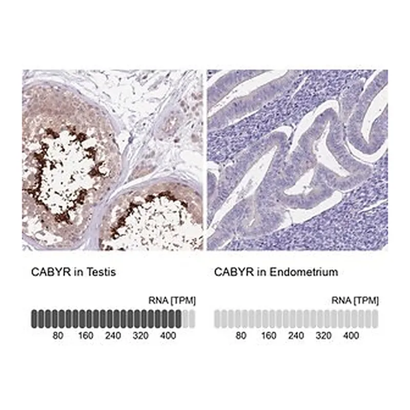 Merck Anti-CABYR antibody produced in rabbit