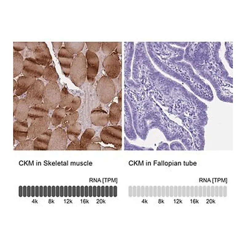 Merck Anti-CKM antibody produced in rabbit