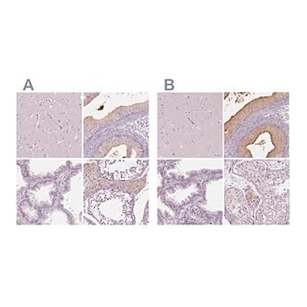 Merck Anti-ELSPBP1 antibody produced in rabbit