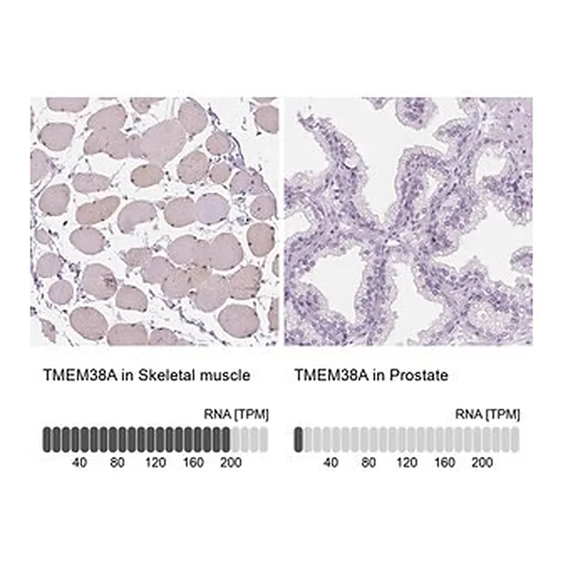 Merck Anti-TMEM38A antibody produced in rabbit