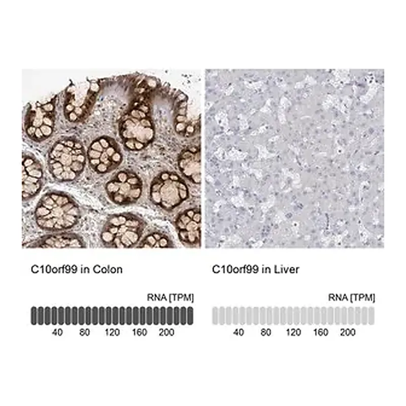 Merck Anti-C10ORF99 antibody produced in rabbit