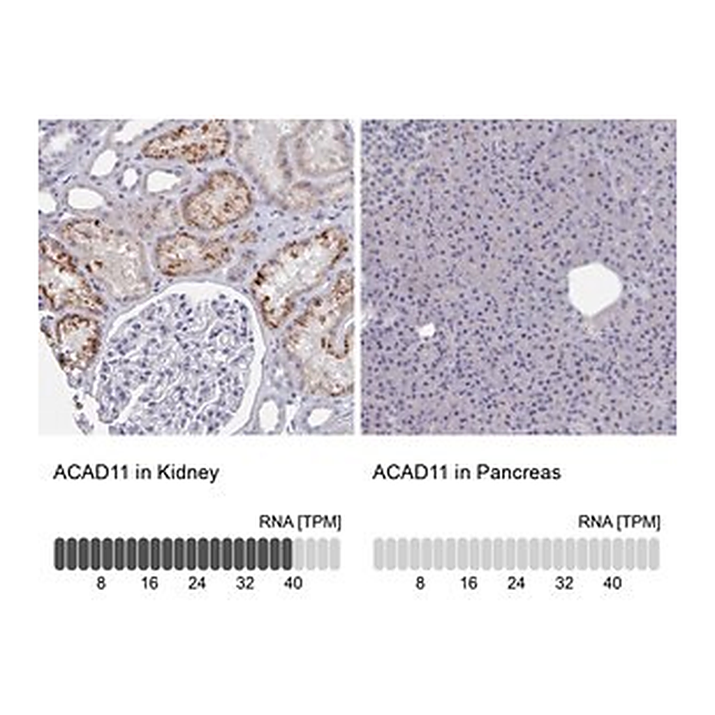 Merck Anti-ACAD11 antibody produced in rabbit