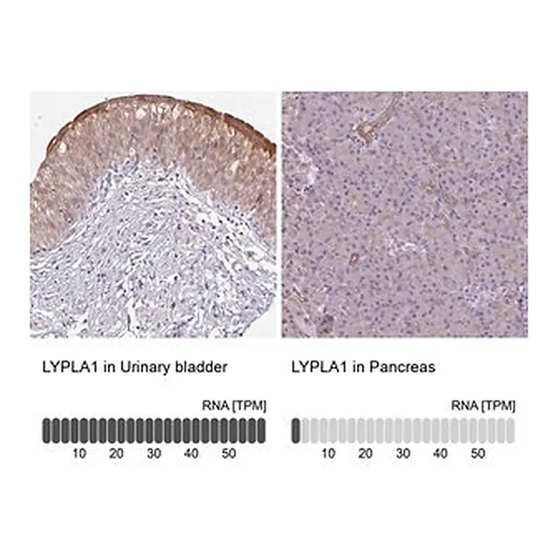 Merck Anti-LYPLA1 antibody produced in rabbit