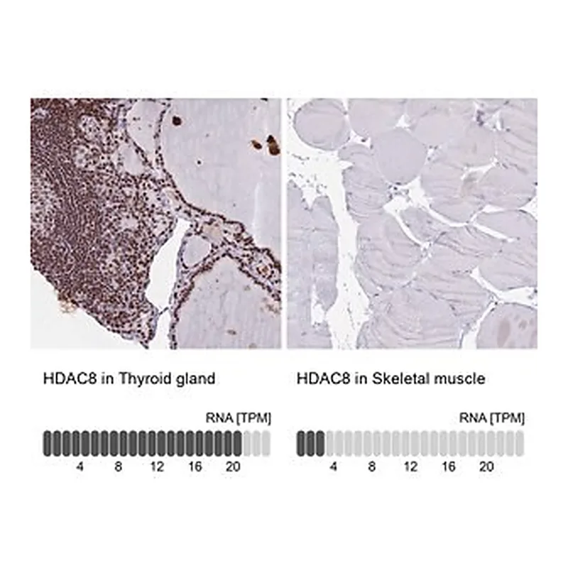 Merck Anti-HDAC8 antibody produced in rabbit