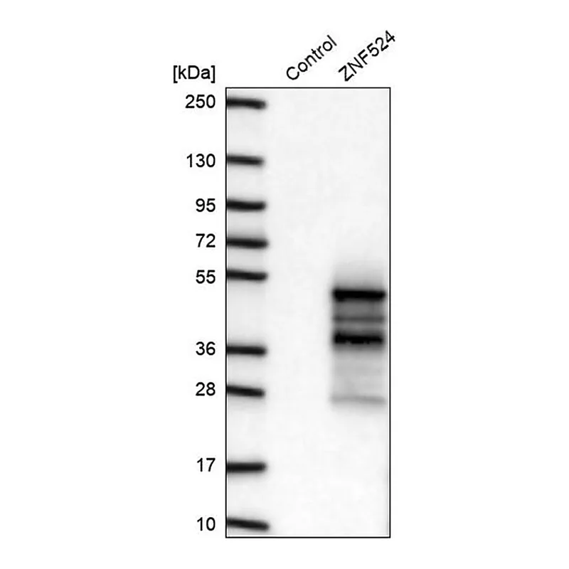 Merck Anti-ZNF524 antibody produced in rabbit